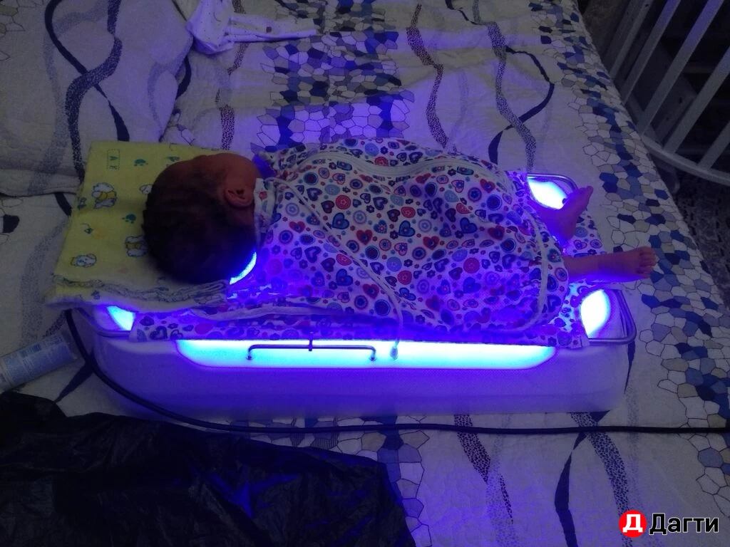 Фотолампа от желтушки